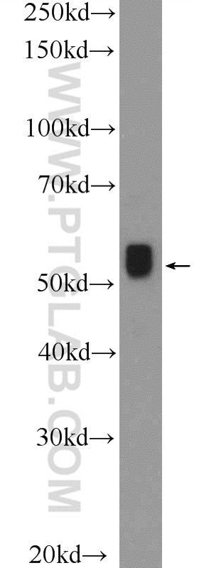 Western Blot (WB) analysis of Jurkat cells using MYEOV Polyclonal antibody (11151-1-AP)