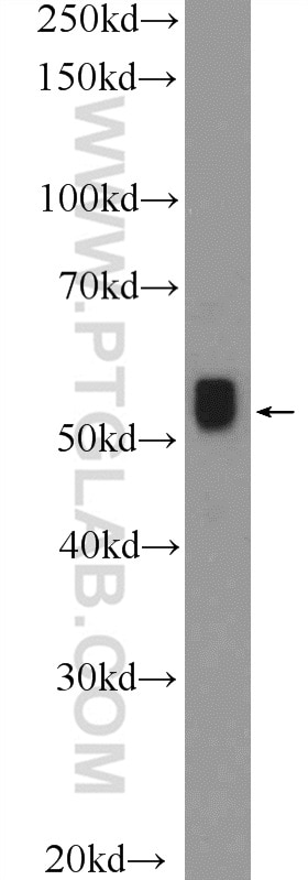 WB analysis of Jurkat using 11151-1-AP