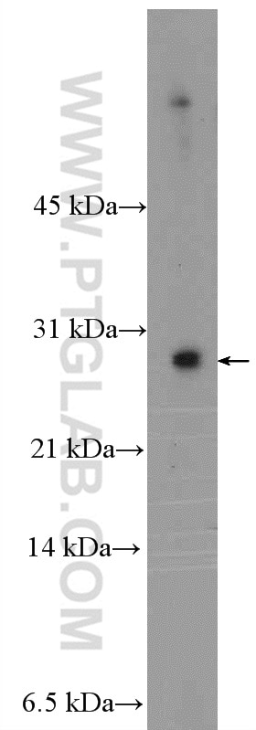 Western Blot (WB) analysis of MCF-7 cells using MYEOV2 Polyclonal antibody (26151-1-AP)