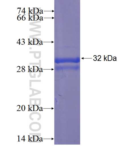 MYEOV2 fusion protein Ag23560 SDS-PAGE
