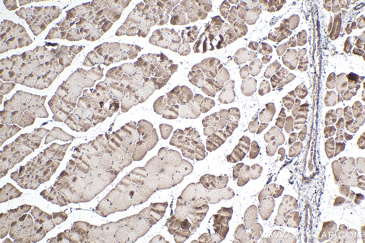 Immunohistochemistry (IHC) staining of mouse skeletal muscle tissue using MYF6 Polyclonal antibody (11754-1-AP)