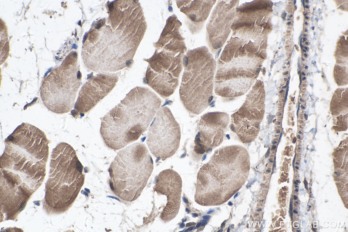 Immunohistochemistry (IHC) staining of mouse skeletal muscle tissue using MYF6 Polyclonal antibody (11754-1-AP)