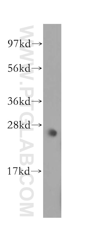 WB analysis of mouse skeletal muscle using 11754-1-AP