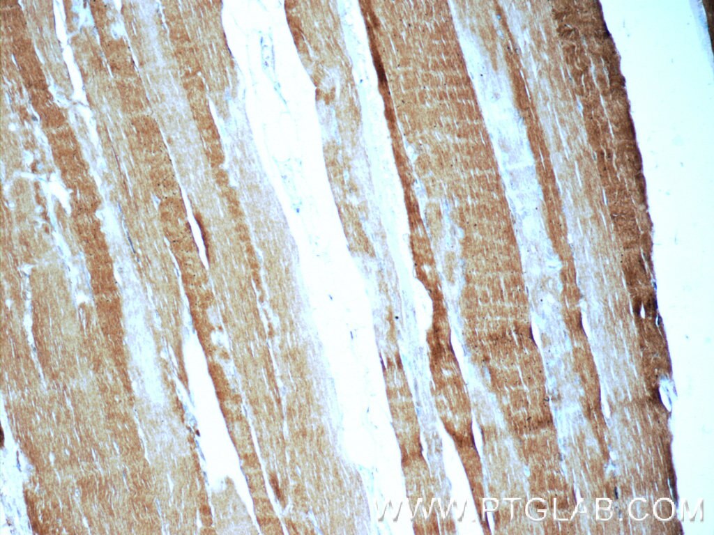 Immunohistochemistry (IHC) staining of human skeletal muscle tissue using MYH1-motor domain Polyclonal antibody (22282-1-AP)