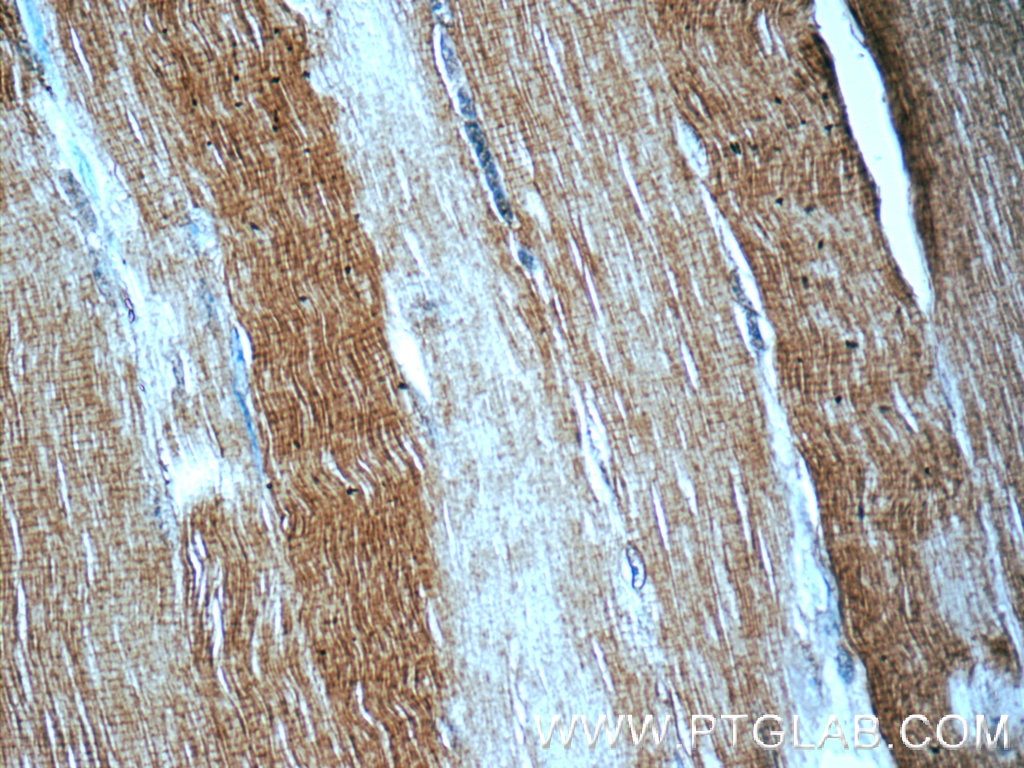 Immunohistochemistry (IHC) staining of human skeletal muscle tissue using MYH1-motor domain Polyclonal antibody (22282-1-AP)