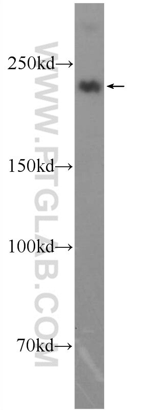 Western Blot (WB) analysis of human skeletal muscle tissue using MYH1-motor domain Polyclonal antibody (22282-1-AP)