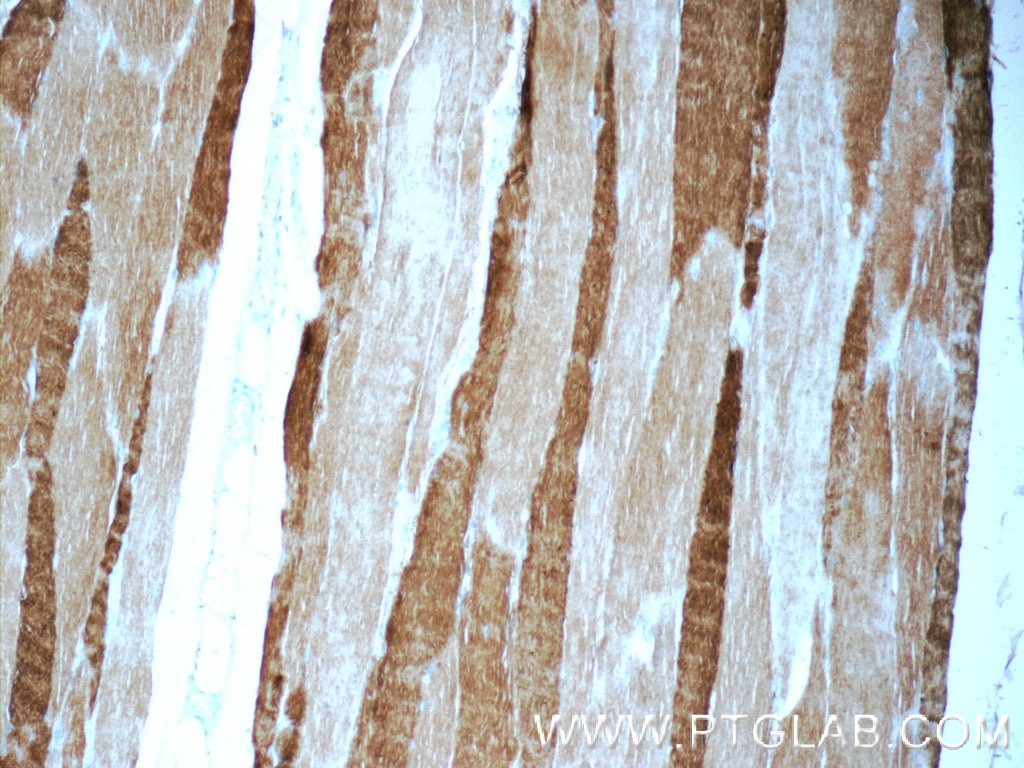 IHC staining of human skeletal muscle using 25182-1-AP