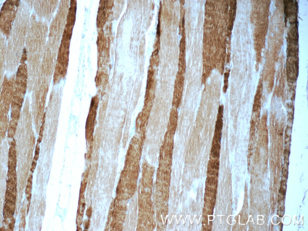 Immunohistochemistry (IHC) staining of human skeletal muscle tissue using MYH1 (N-terminal) Polyclonal antibody (25182-1-AP)