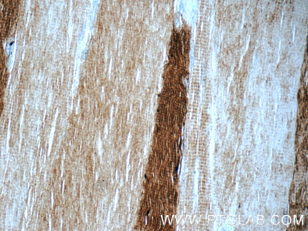 Immunohistochemistry (IHC) staining of human skeletal muscle tissue using MYH1 (N-terminal) Polyclonal antibody (25182-1-AP)