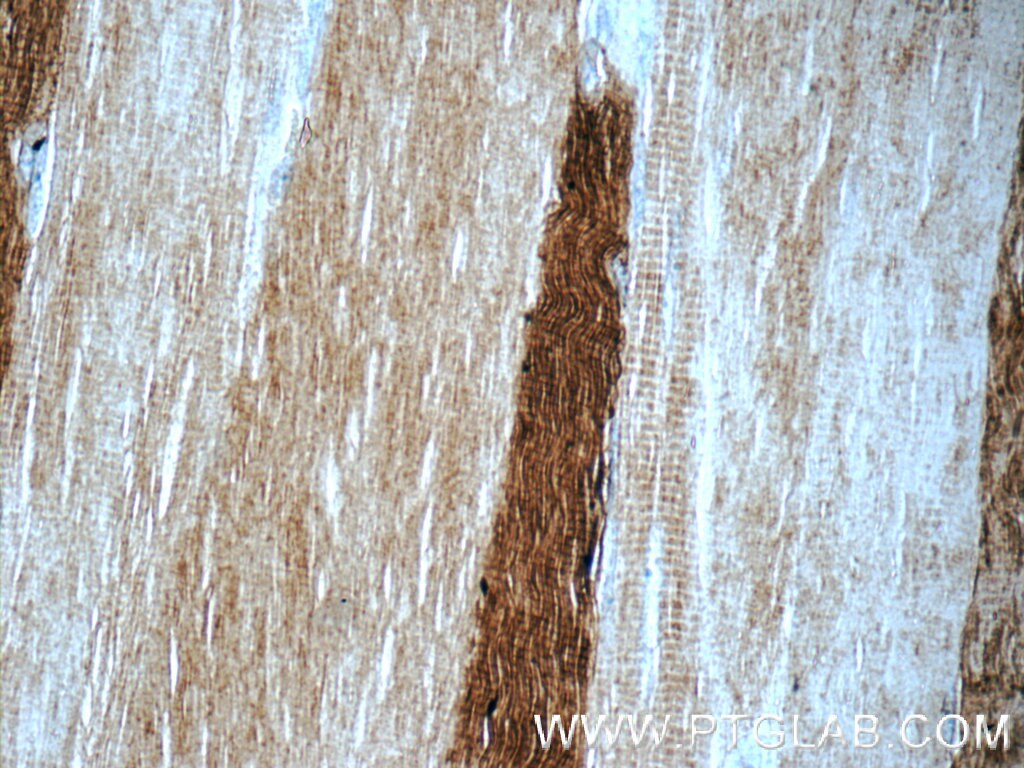 MYH1 (N-terminal) Polyclonal antibody