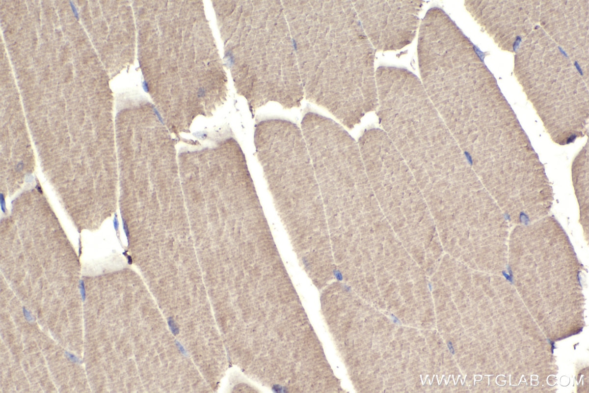 Immunohistochemistry (IHC) staining of mouse skeletal muscle tissue using MYH1 (N-terminal) Polyclonal antibody (25182-1-AP)