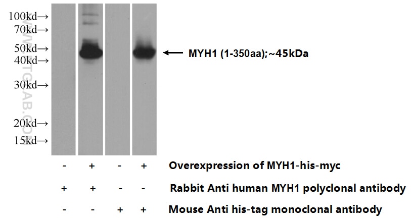 MYH1 (N-terminal)