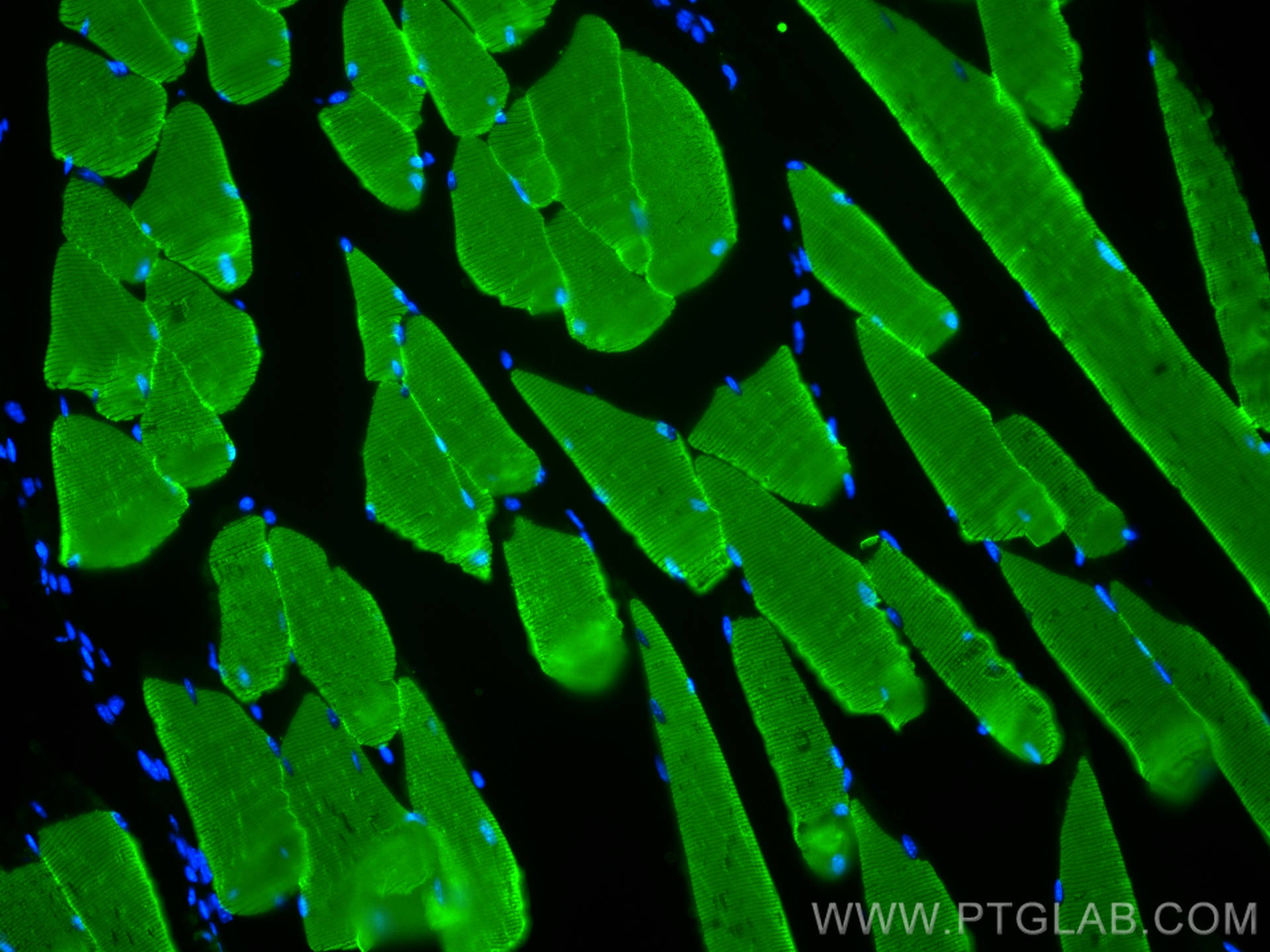 Immunofluorescence (IF) / fluorescent staining of mouse skeletal muscle tissue using MYH1 Monoclonal antibody (67299-1-Ig)