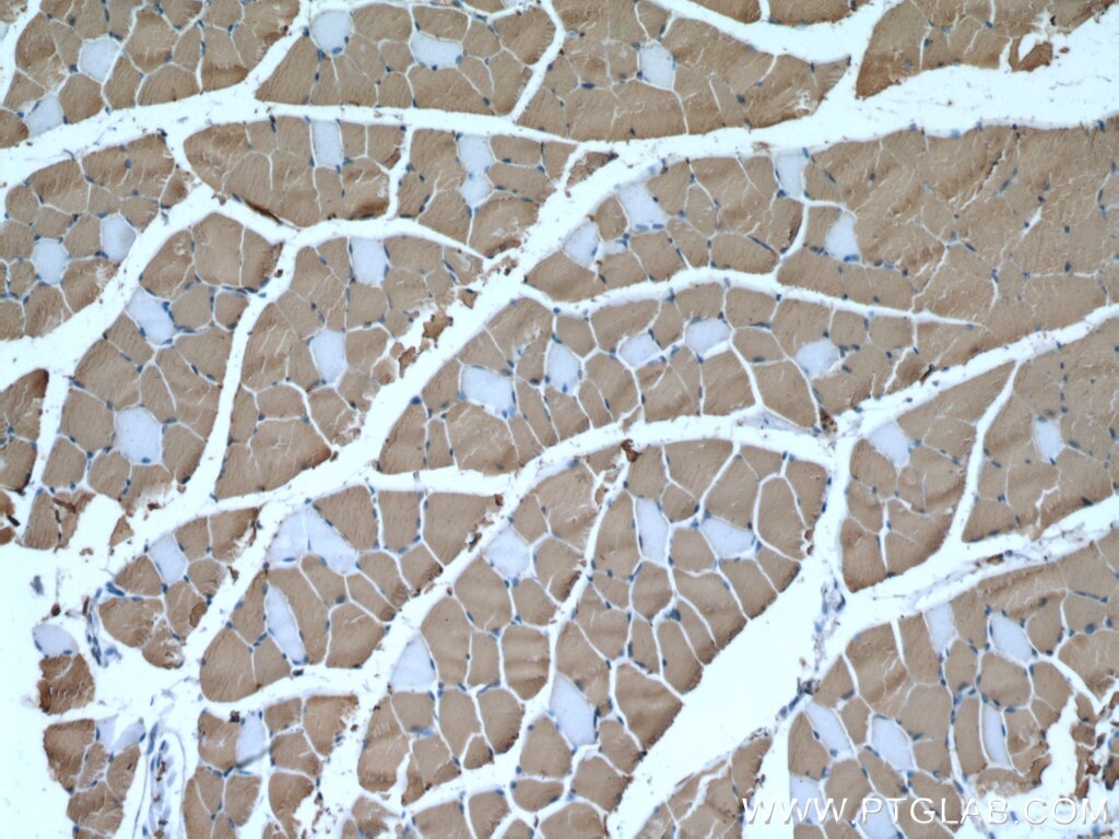 Immunohistochemistry (IHC) staining of mouse skeletal muscle tissue using MYH1 Monoclonal antibody (67299-1-Ig)