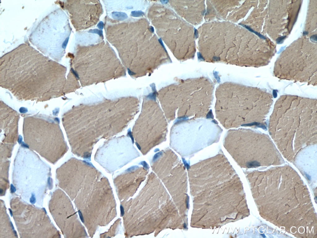 Immunohistochemistry (IHC) staining of mouse skeletal muscle tissue using MYH1 Monoclonal antibody (67299-1-Ig)