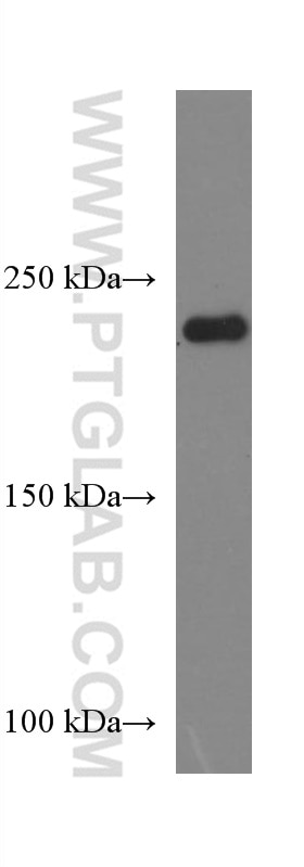 Western Blot (WB) analysis of human skeletal muscle tissue using MYH1 Monoclonal antibody (67299-1-Ig)