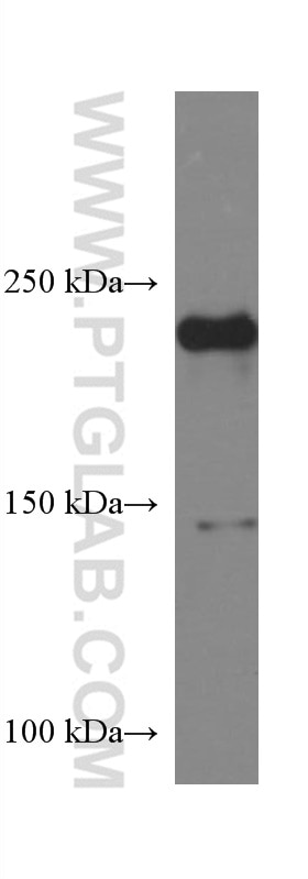 Western Blot (WB) analysis of pig skeletal muscle tissue using MYH1 Monoclonal antibody (67299-1-Ig)