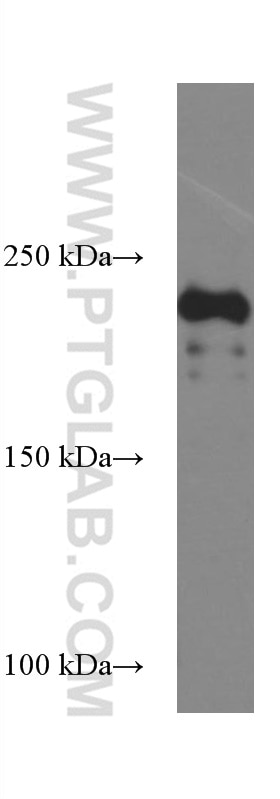 Western Blot (WB) analysis of mouse skeletal muscle tissue using MYH1 Monoclonal antibody (67299-1-Ig)