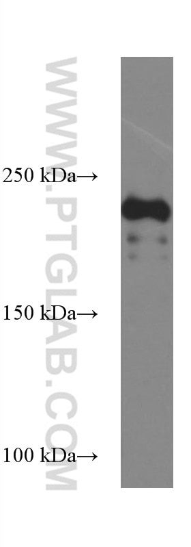 WB analysis of mouse skeletal muscle using 67299-1-Ig