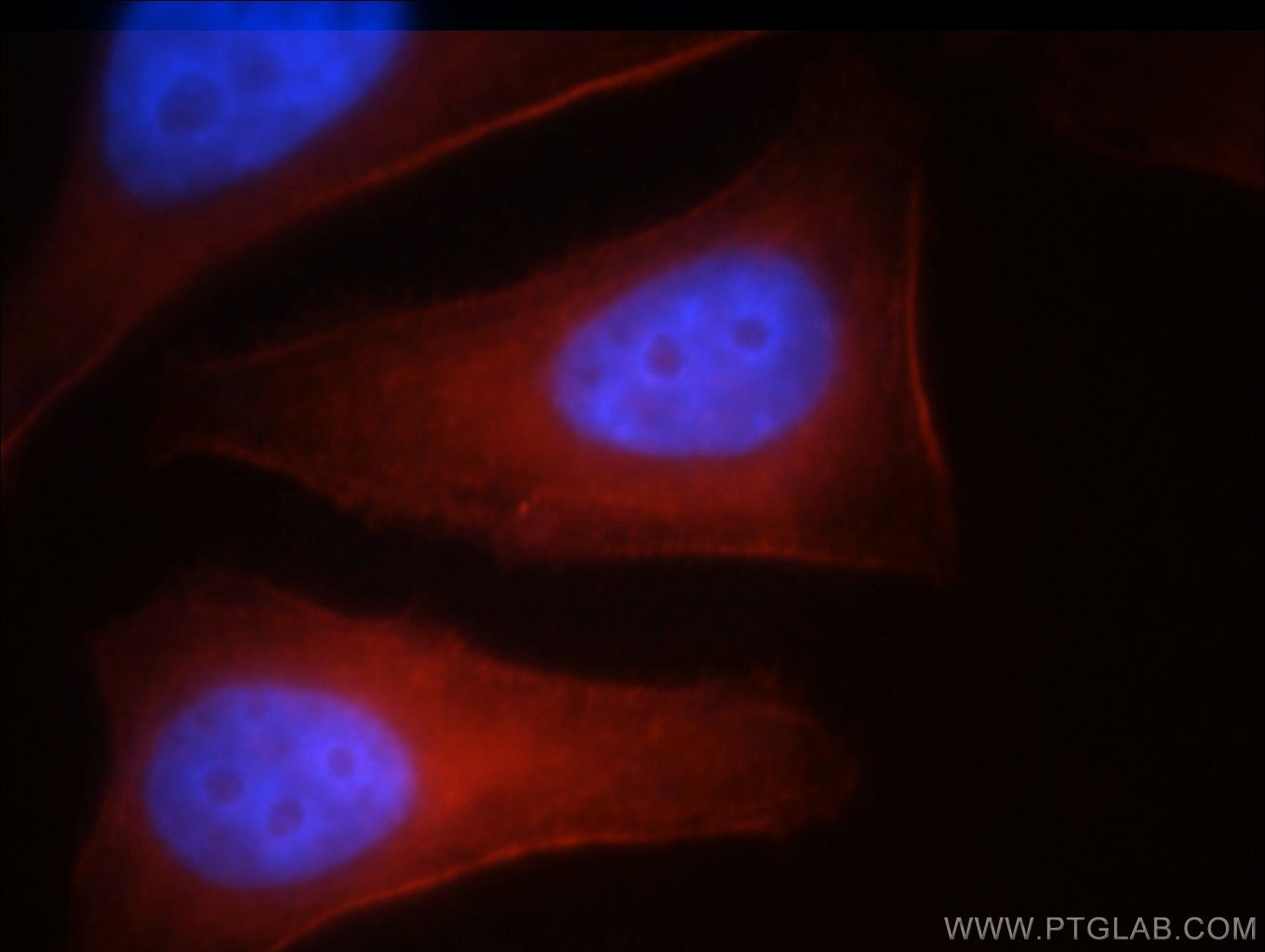 Immunofluorescence (IF) / fluorescent staining of HepG2 cells using MYH10 Polyclonal antibody (21403-1-AP)