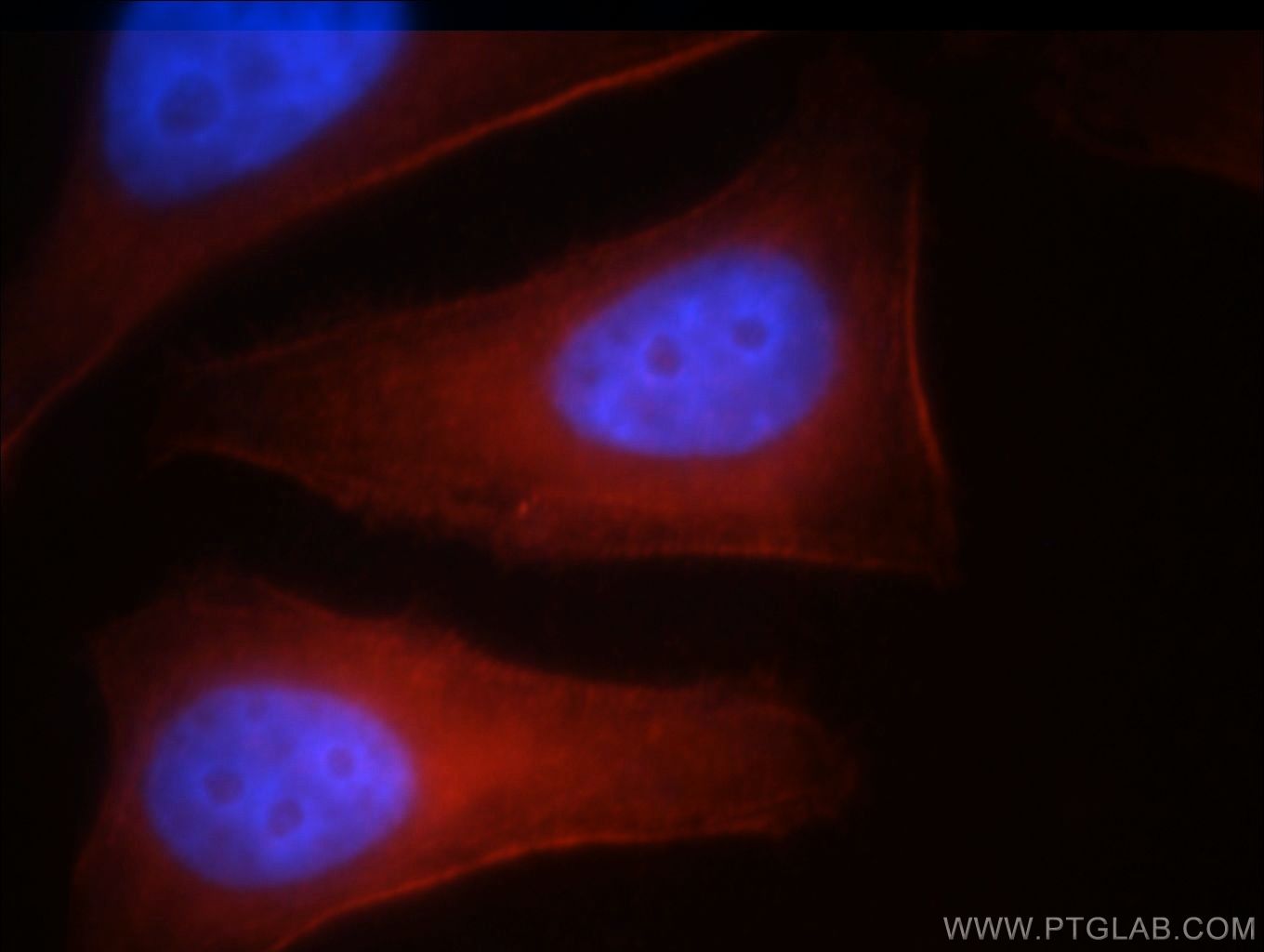 MYH10 Polyclonal antibody