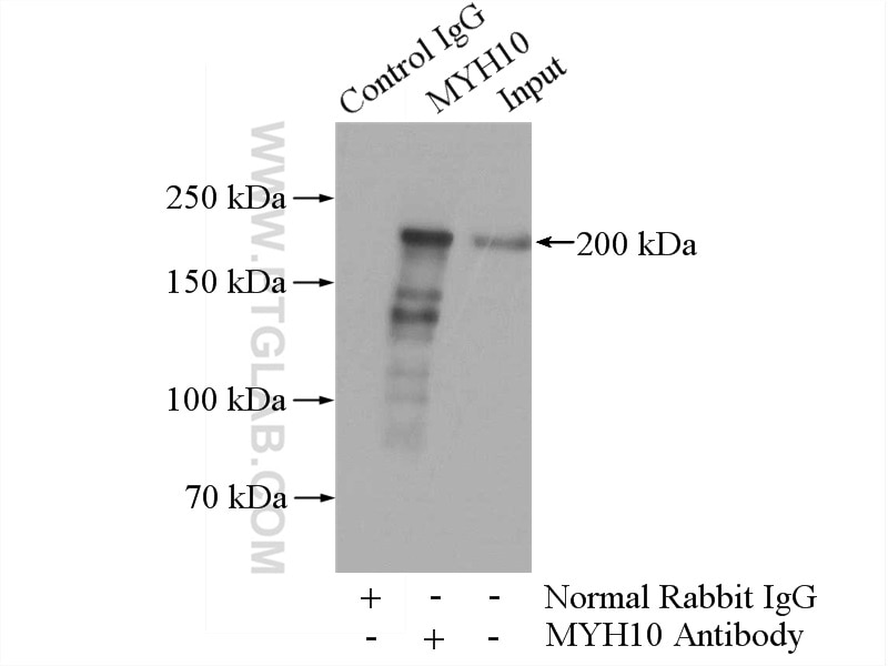 Immunoprecipitation (IP) experiment of mouse brain tissue using MYH10 Polyclonal antibody (21403-1-AP)