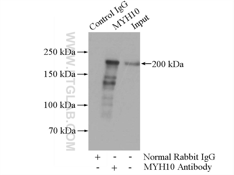 IP experiment of mouse brain using 21403-1-AP