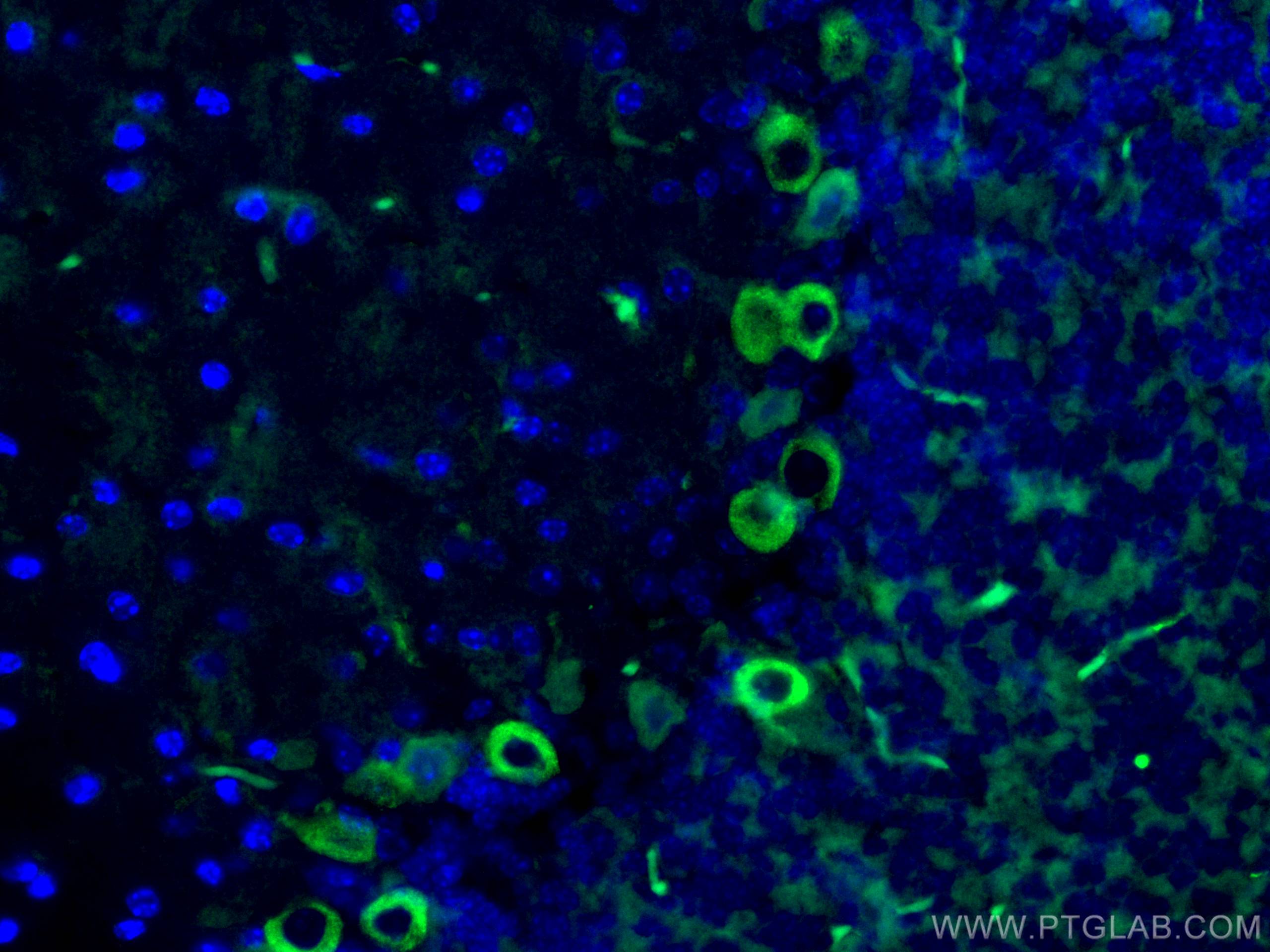 Immunofluorescence (IF) / fluorescent staining of mouse cerebellum tissue using MYH10 Monoclonal antibody (67243-1-Ig)
