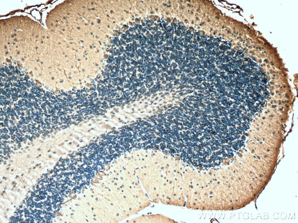 Immunohistochemistry (IHC) staining of mouse cerebellum tissue using MYH10 Monoclonal antibody (67243-1-Ig)