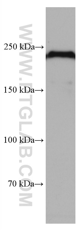 Western Blot (WB) analysis of rat cerebellum tissue using MYH10 Monoclonal antibody (67243-1-Ig)