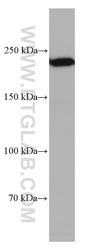 Western Blot (WB) analysis of mouse brain tissue using MYH10 Monoclonal antibody (67243-1-Ig)