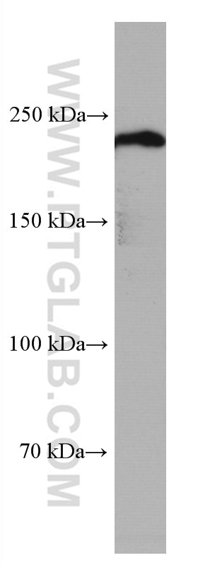 Western Blot (WB) analysis of mouse cerebellum tissue using MYH10 Monoclonal antibody (67243-1-Ig)