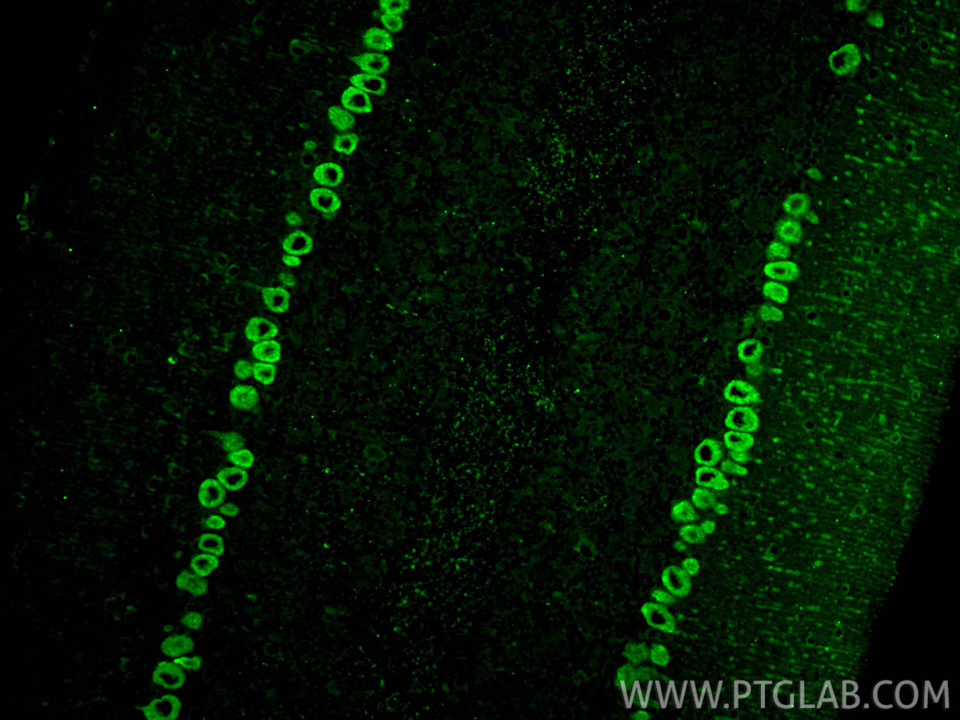 Immunofluorescent analysis of (4% PFA) fixed paraffin-embedded mouse cerebellum tissue using MYH10 antibody (86157-3-RR, Clone: 250791D5 ) at dilution of 1:200 and CoraLite®488-Conjugated Goat Anti-Rabbit IgG(H+L) (SA00013-2). Heat mediated antigen retrieval with Tris-EDTA buffer (pH 9.0). Immunofluorescence (IF) / fluorescent staining of mouse cerebellum tissue using MYH10 Recombinant monoclonal antibody (86157-3-RR)
