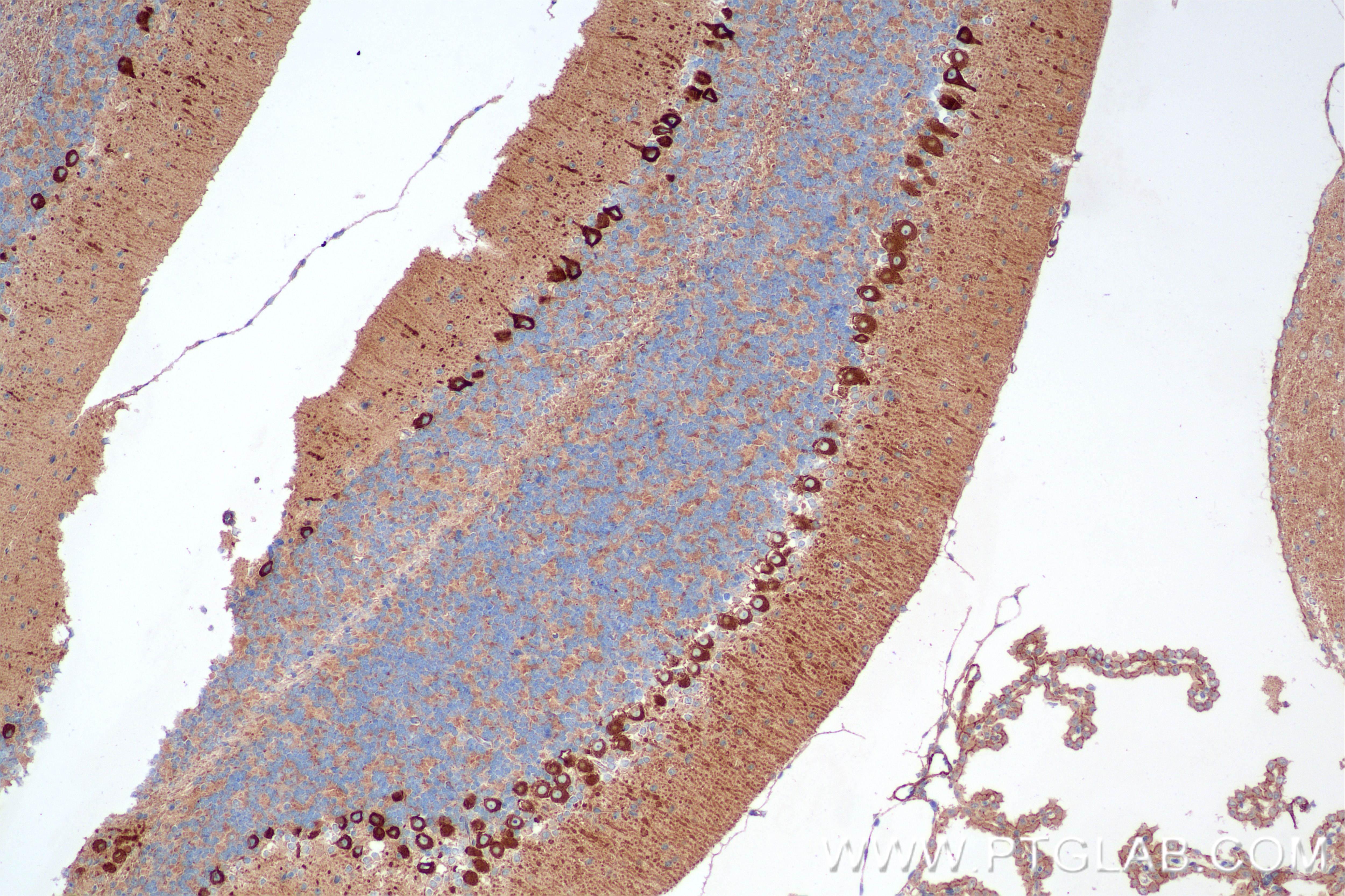MYH10