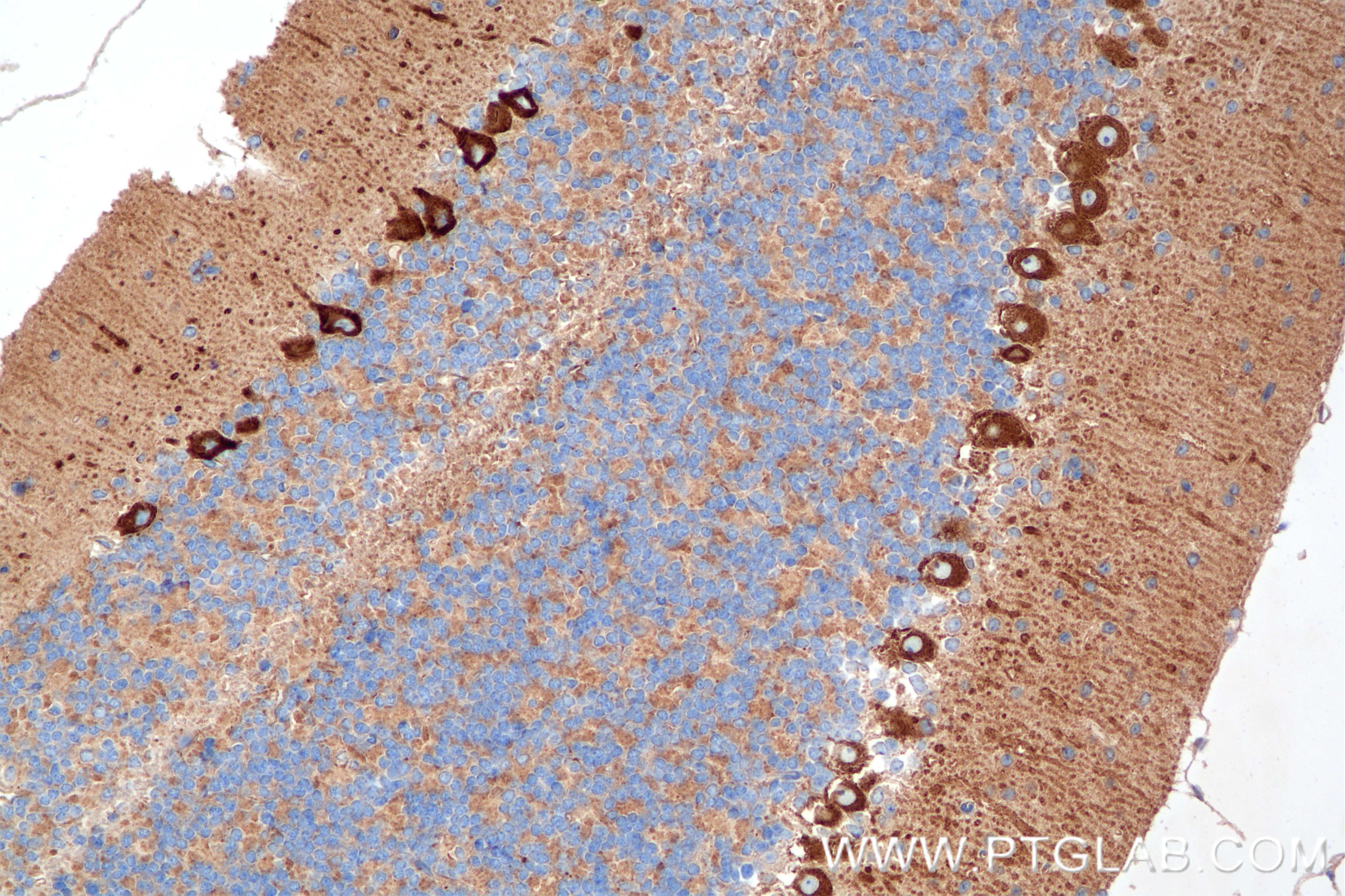 Immunohistochemistry (IHC) staining of mouse cerebellum tissue using MYH10 Recombinant antibody (86157-3-RR)