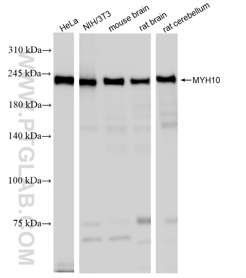 Western Blot (WB) analysis of various lysates using MYH10 Recombinant antibody (86157-3-RR)