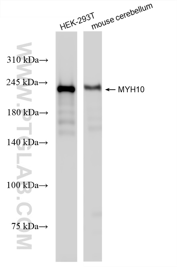 Western Blot (WB) analysis of various lysates using MYH10 Recombinant antibody (86157-3-RR)