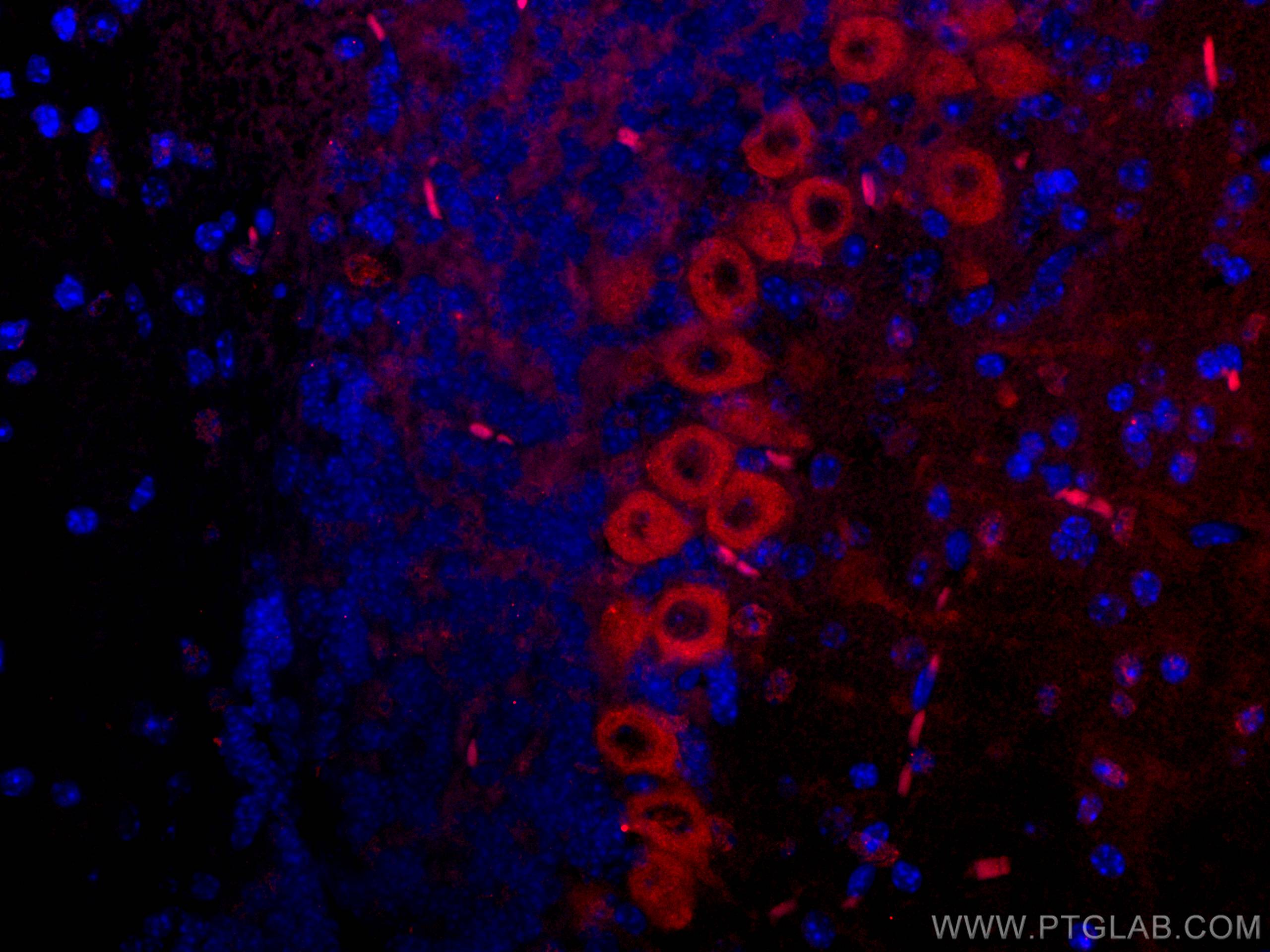 Immunofluorescence (IF) / fluorescent staining of mouse cerebellum tissue using CoraLite®594-conjugated MYH10 Monoclonal antibody (CL594-67243)