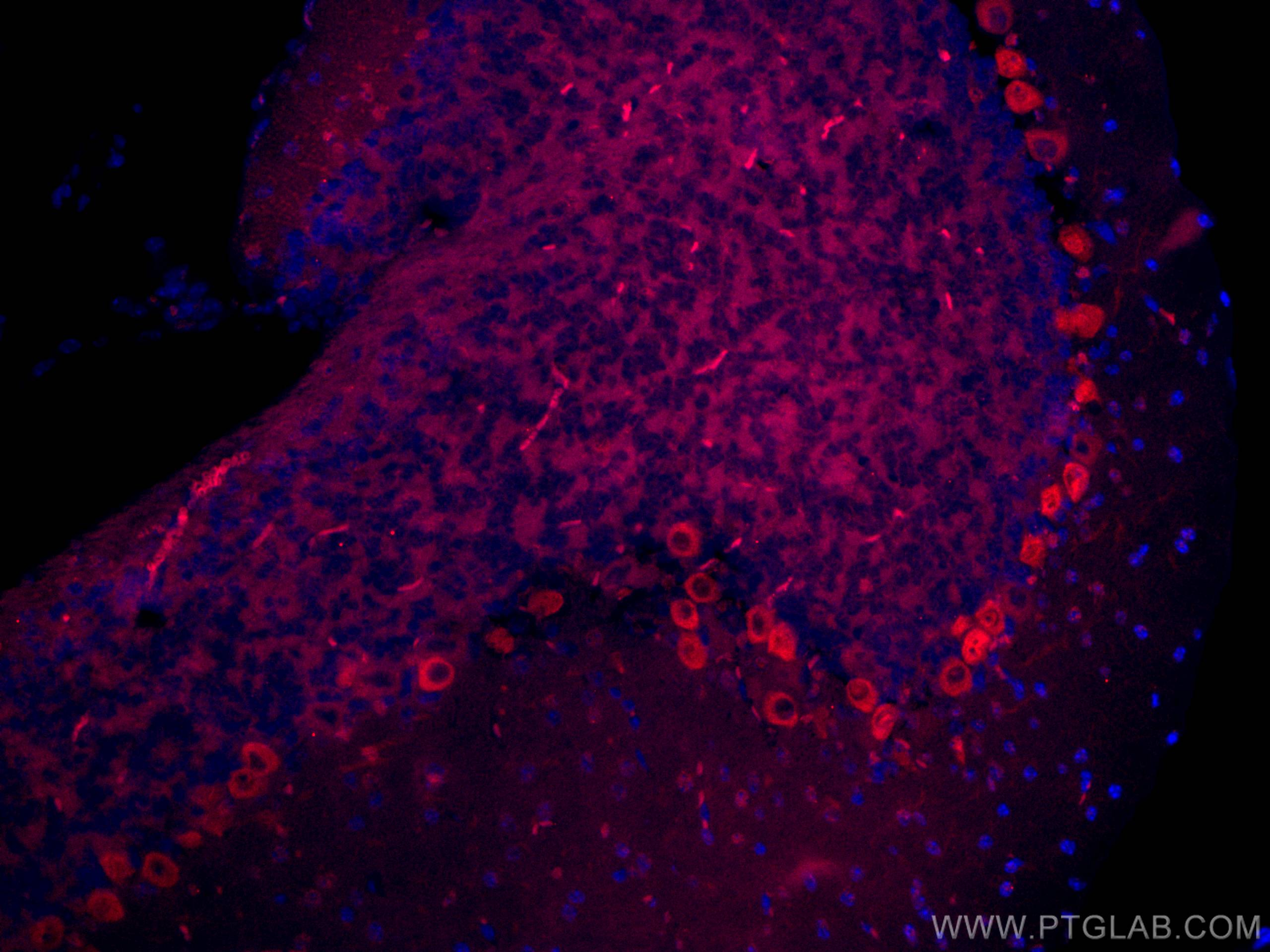 Immunofluorescence (IF) / fluorescent staining of mouse cerebellum tissue using CoraLite®594-conjugated MYH10 Monoclonal antibody (CL594-67243)