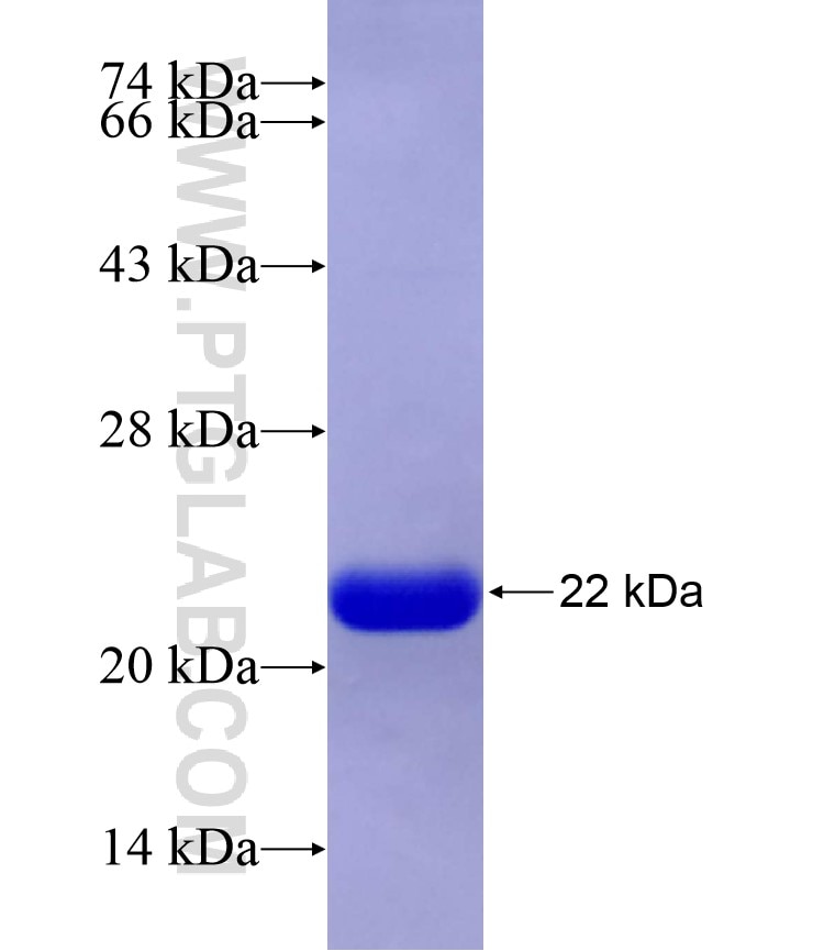 MYH10 fusion protein Ag17069 SDS-PAGE