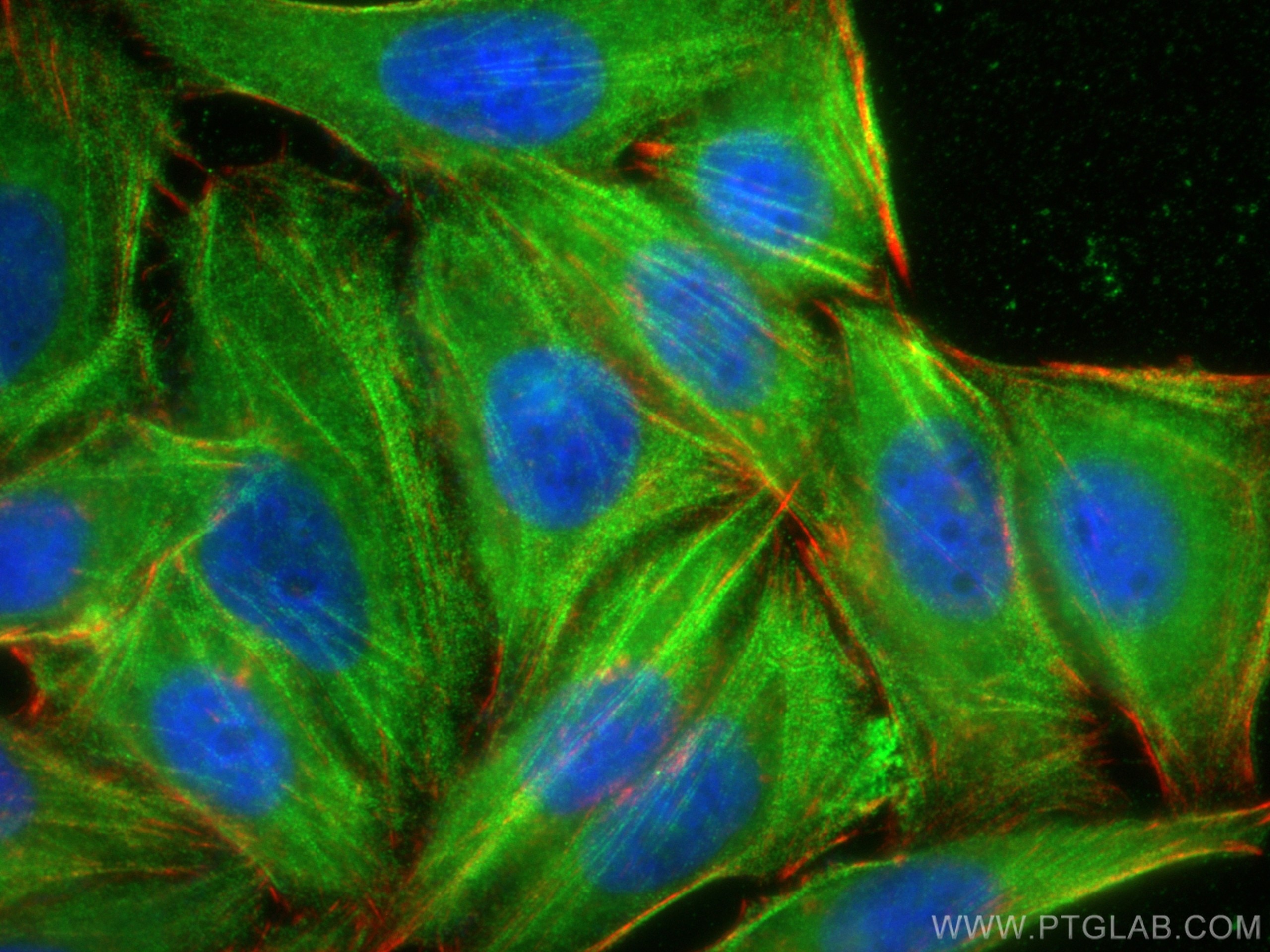 Immunofluorescence (IF) / fluorescent staining of HepG2 cells using MYH10-Specific Polyclonal antibody (19673-1-AP)