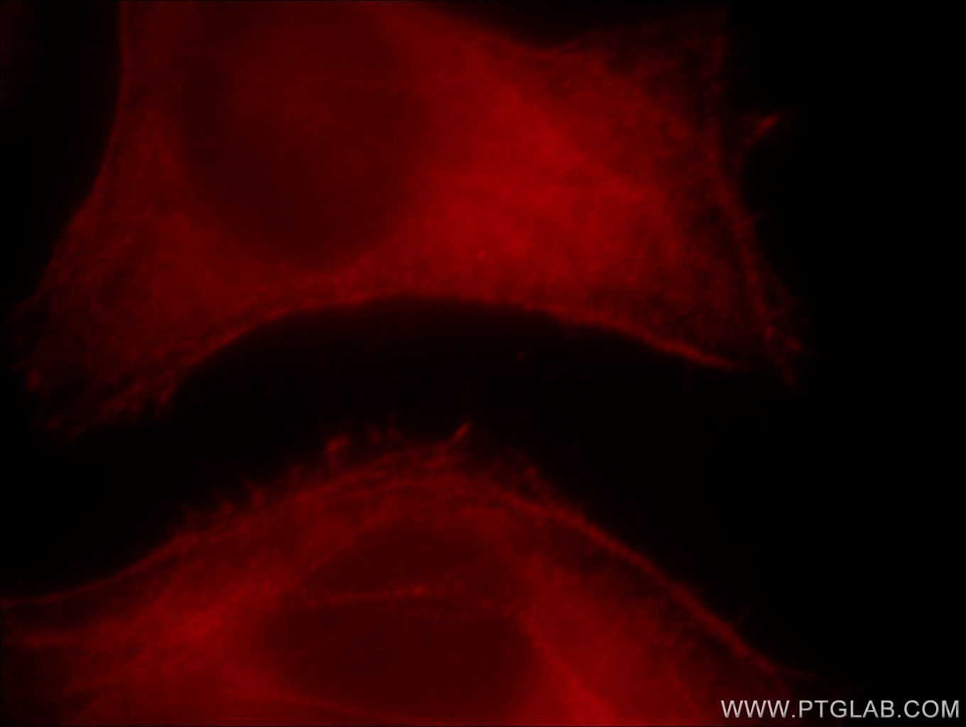 Immunofluorescence (IF) / fluorescent staining of HepG2 cells using MYH10-Specific Polyclonal antibody (19673-1-AP)