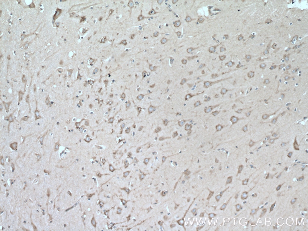 Immunohistochemistry (IHC) staining of human brain tissue using MYH10-Specific Polyclonal antibody (19673-1-AP)