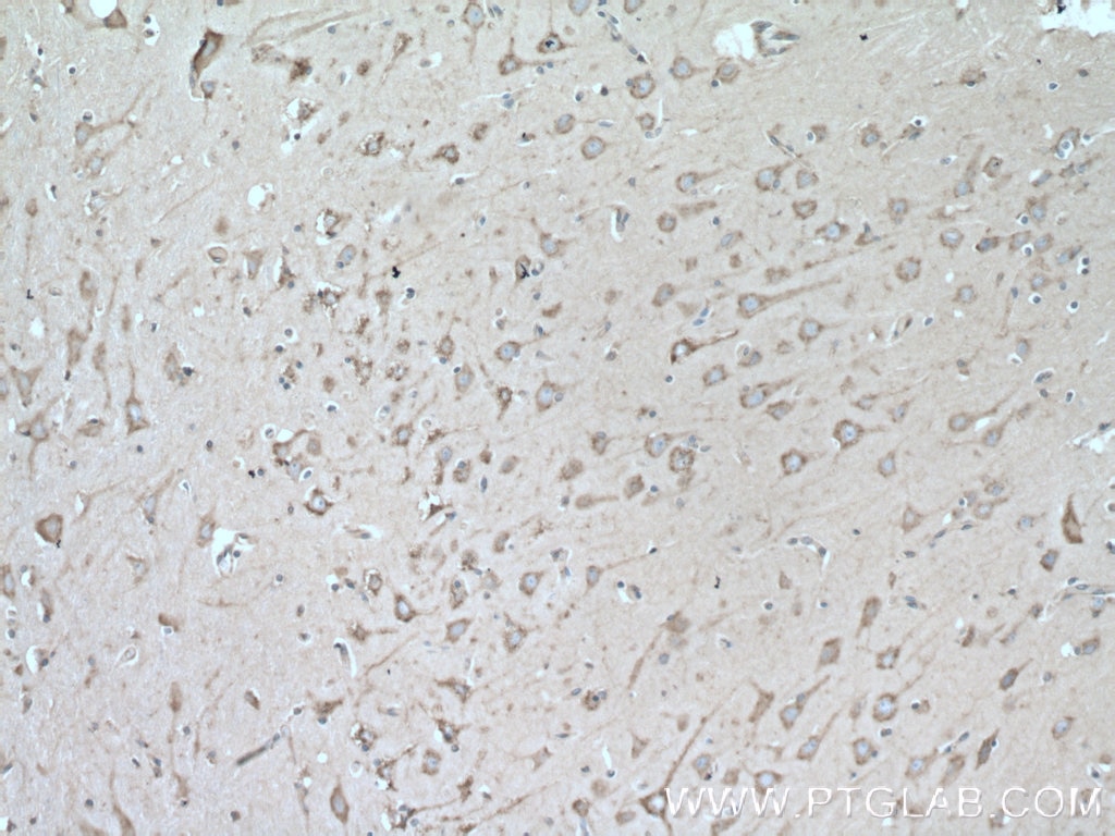 IHC staining of human brain using 19673-1-AP