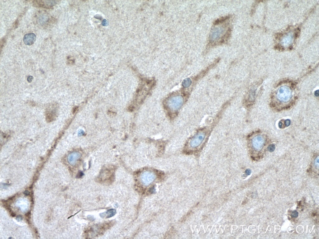 Immunohistochemistry (IHC) staining of human brain tissue using MYH10-Specific Polyclonal antibody (19673-1-AP)