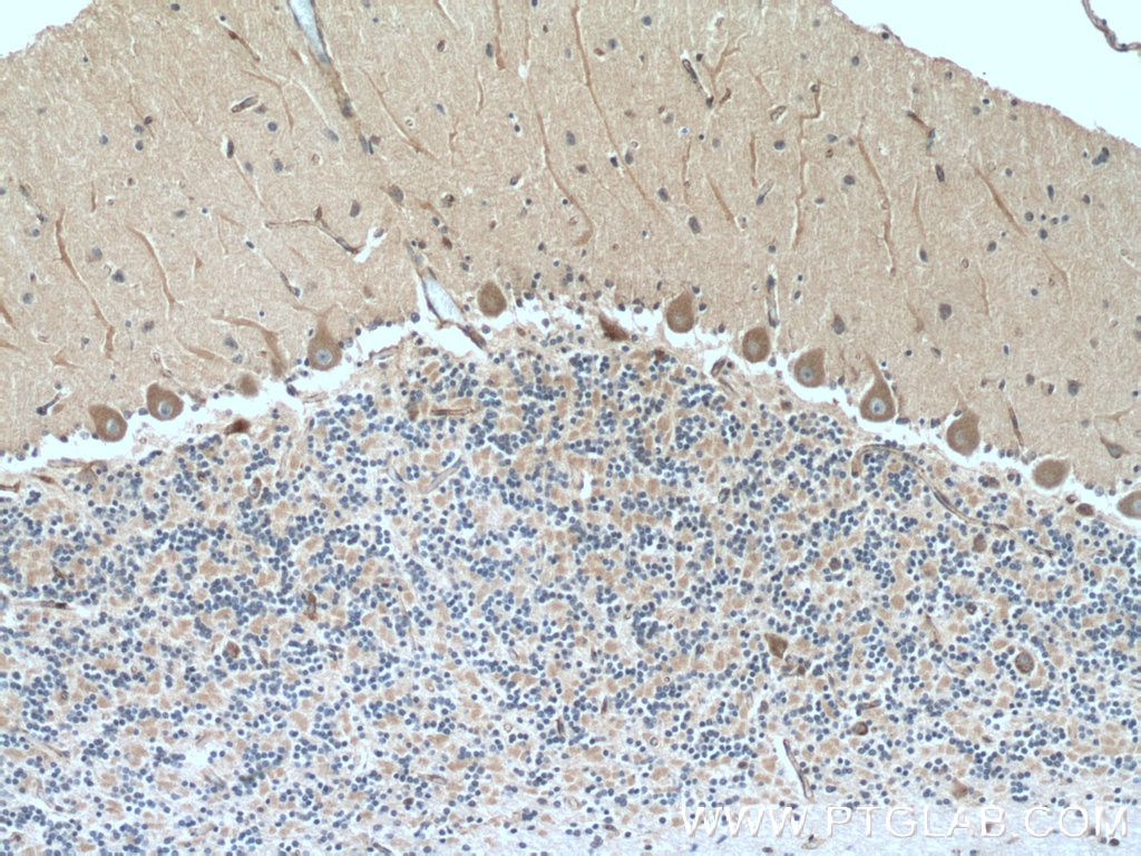 Immunohistochemistry (IHC) staining of human cerebellum tissue using MYH10-Specific Polyclonal antibody (19673-1-AP)