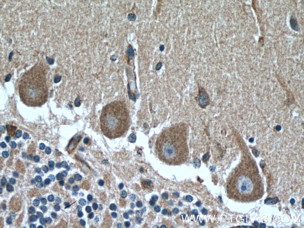 Immunohistochemistry (IHC) staining of human cerebellum tissue using MYH10-Specific Polyclonal antibody (19673-1-AP)