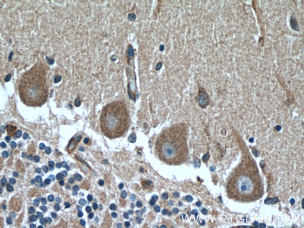 IHC staining of human cerebellum using 19673-1-AP