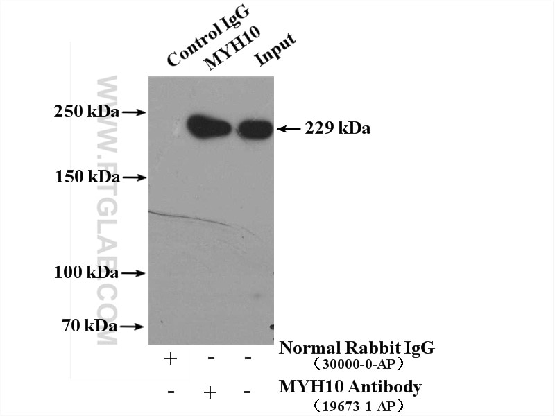 Immunoprecipitation (IP) experiment of mouse brain tissue using MYH10-Specific Polyclonal antibody (19673-1-AP)