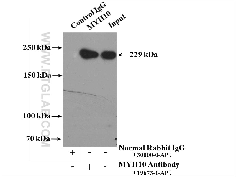 IP experiment of mouse brain using 19673-1-AP